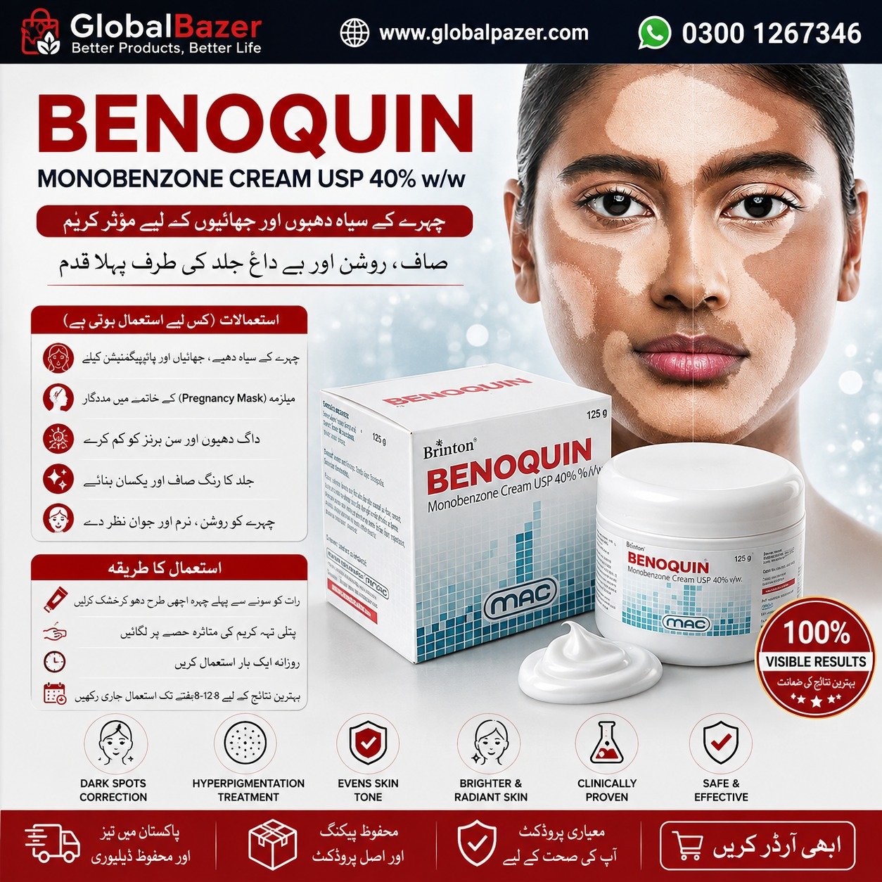Benoquin Monobenzone Cream Original Packaging for Vitiligo Treatment