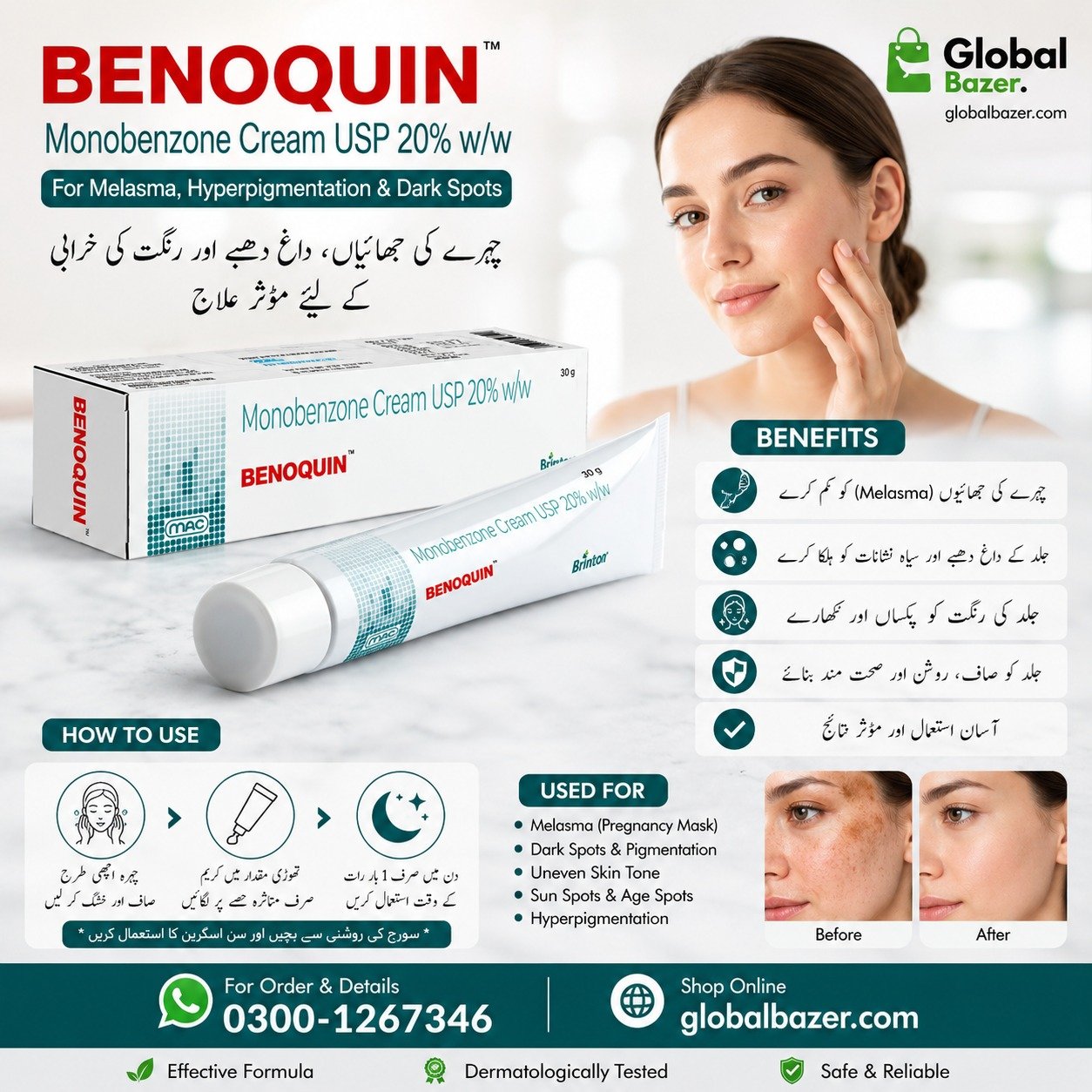 : https://globalbazer.com/product/natural-benoquin-cream-pakistan/ 